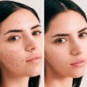 Crema facial hidratante, piel grasa y acné, con CBD, ecológica - Herbera Biocosmética