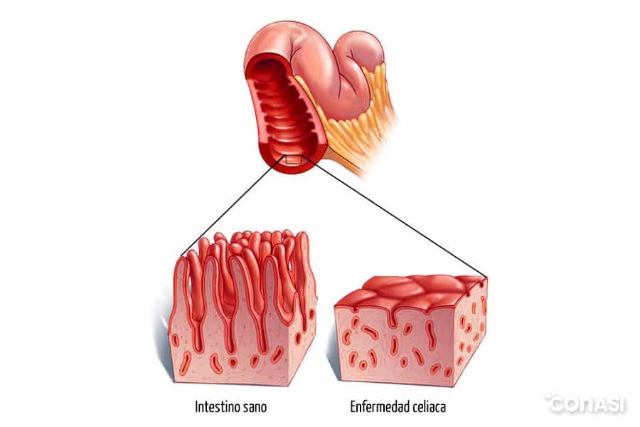 microvellosidades-intestino