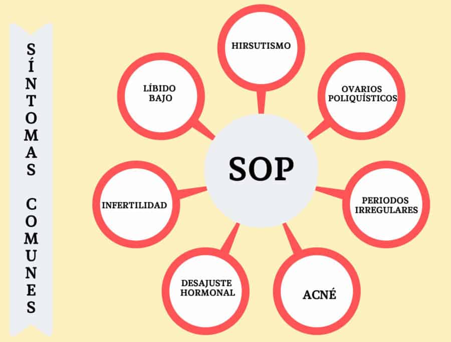 Esquema de los diferentes síntomas del Síndrome de Ovario Poliquístico